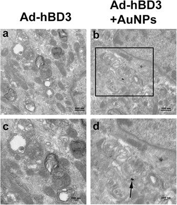 Gold Nanoparticles Combined Human β-Defensin 3 Gene-Modified Human Periodontal Ligament Cells Alleviate Periodontal Destruction via the p38 MAPK Pathway